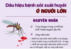 sốt xuất huyết ở người lớn