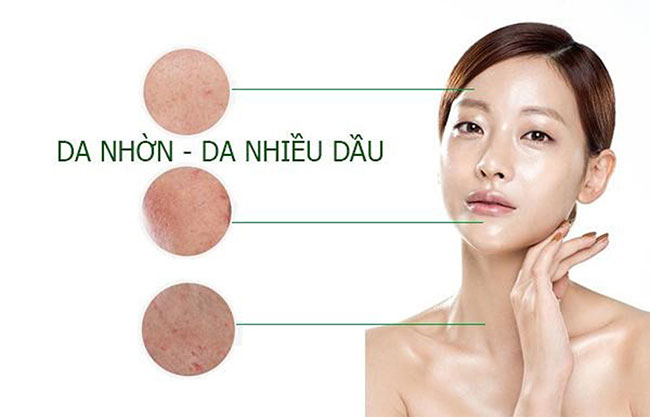 cham-soc-da-dau-2 đặc điểm của da dầu