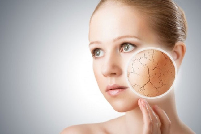 da-kho-phai-lam-sao-1 Da khô là gì