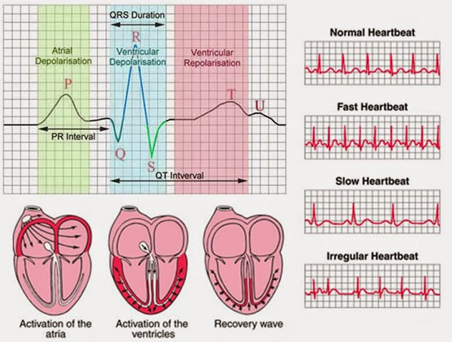 ưu nhược điểm của ecg