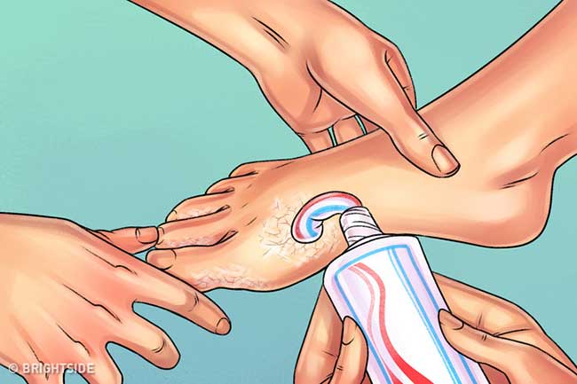 mem-da-chan-bang-kem-danh-rang dùng kem đánh răng làm mèm da chân