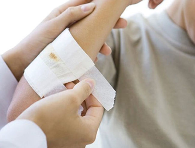 công dụng của tinh dầu tràm Chữa lành vết thương nhanh chóng